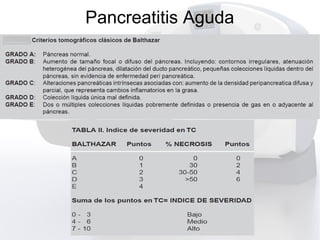 Pancreatitis Aguda
 
