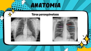 Comprehensive Radiographic Techniques and Pathologies of the Thorax | PDF