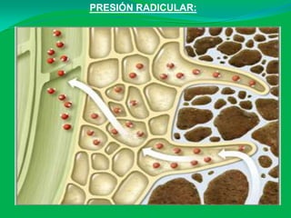 PRESIÓN RADICULAR:
 