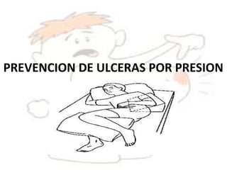 PREVENCION DE ULCERAS POR PRESION
 