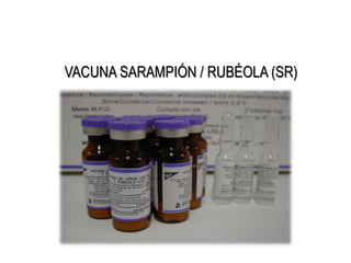 VACUNA SARAMPIÓN / RUBÉOLA (SR)
 