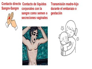 Presentación vih