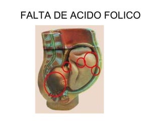 FALTA DE ACIDO FOLICO
 