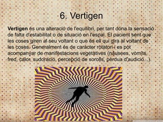 6. Vertigen
Vertigen és una alteració de l'equilibri, per tant dóna la sensació
de falta d'estabilitat o de situació en l'espai. El pacient sent que
les coses giren al seu voltant o que és ell qui gira al voltant de
les coses. Generalment és de caràcter rotatori i es pot
acompanyar de manifestacions vegetatives (nàusees, vòmits,
fred, calor, sudoració, percepció de sorolls, pèrdua d'audició...).
 