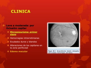 CLINICA
 Leve a moderada: por
Oclusión capilar
 Microaneurisma: primer
signo
 Hemorragias intrarretinianas
 Exudados duros y blandos
 Alteraciones de los capilares en
la zona perifoveal
 Edema macular
 