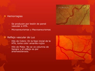  Hemorragias
– Se producen por lesión de pared
vascular e HTA.
– Microaneurismas y Macroaneurismas
 Reflejo vascular de Luz
– Hilo de Cobre: En la fase inicial de la
HTA, toma color amarillo-rojizo
– Hilo de Plata: No se ve columna de
Sangre y el reflejo es por
arteroesclerosis.
 