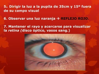 5. Dirigir la luz a la pupila de 35cm y 15º fuera
de su campo visual
6. Observar una luz naranja  REFLEJO ROJO.
7. Mantener el rayo y acercarse para visualizar
la retina (disco óptico, vasos sang.)
 