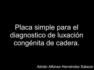 Placa simple para el diagnostico de luxación congénita de cadera. Adrián Alfonso Hernández Salazar 