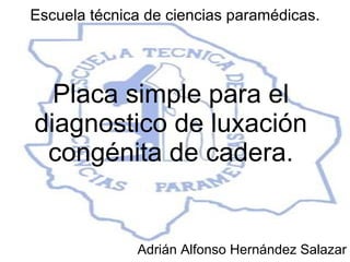 Placa simple para el diagnostico de luxación congénita de cadera. Adrián Alfonso Hernández Salazar Escuela técnica de ciencias paramédicas. 