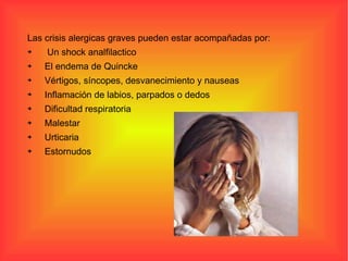 Las crisis alergicas graves pueden estar acompañadas por: Un shock analfilactico  El endema de Quincke Vértigos, síncopes, desvanecimiento y nauseas Inflamación de labios, parpados o dedos Dificultad respiratoria Malestar Urticaria Estornudos 