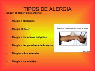 TIPOS DE ALERGIA Según el origen del alérgeno: Alergia a alimentos Alergia al polen Alergia a los ácaros del polvo Alergia a las picaduras de insectos Alergias a los animales Alergia a los metales 