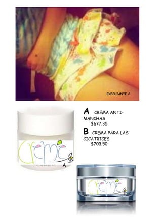 EXFOLIANTE C




    A  CREMA ANTI-
    MANCHAS
      $677.35

    B   CREMA PARA LAS
    CICATRICES
       $703.50




A
 