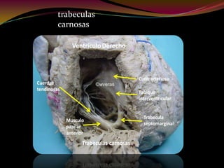 trabeculas
carnosas
 