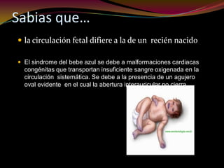 Sabias que…
 la circulación fetal difiere a la de un recién nacido
 El sindrome del bebe azul se debe a malformaciones cardiacas
congénitas que transportan insuficiente sangre oxigenada en la
circulación sistemática. Se debe a la presencia de un agujero
oval evidente en el cual la abertura interauricular no cierra.
 