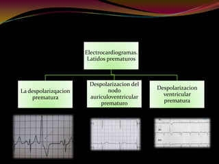 Electrocardiogramas.
Latidos prematuros
La despolarizqacion
prematura
Despolarizacion del
nodo
auriculoventricular
prematuro
Despolarizacion
ventricular
prematura
 
