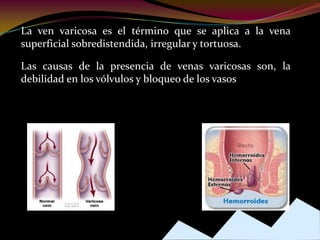 La ven varicosa es el término que se aplica a la vena
superficial sobredistendida, irregular y tortuosa.
Las causas de la presencia de venas varicosas son, la
debilidad en los vólvulos y bloqueo de los vasos
 