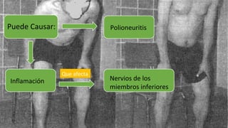 Puede Causar:
Inflamación
Polioneuritis
Que afecta
Nervios de los
miembros inferiores