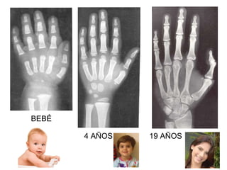 BEBÉ
4 AÑOS 19 AÑOS