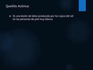 Queilitis Actínica:
 Es una lesión de labio producida por los rayos del sol
en las personas de piel muy blanca
 