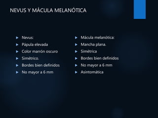NEVUS Y MÁCULA MELANÓTICA
 Nevus:
 Pápula elevada
 Color marrón oscuro
 Simétrico.
 Bordes bien definidos
 No mayor a 6 mm
 Mácula melanótica:
 Mancha plana.
 Simétrica
 Bordes bien definidos
 No mayor a 6 mm
 Asintomática
 