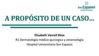 A PROPÓSITO DE UN CASO…
Elisabeth Vanrell Büse
R1 Dermatología médico-quirúrgica y venereología
Hospital Universitario Son Espases
 
