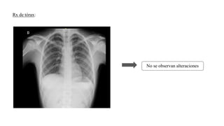 Rx de tórax:
No se observan alteraciones
 