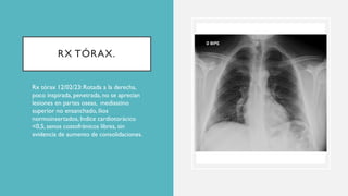 RX TÓRAX.
• Rx tórax 12/02/23:Rotada a la derecha,
poco inspirada, penetrada, no se aprecian
lesiones en partes oseas, mediastino
superior no ensanchado, ilios
normoinsertados, Indice cardiotorácico
<0,5, senos costofrénicos libres, sin
evidencia de aumento de consolidaciones.
 