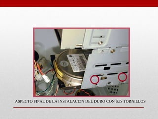ASPECTO FINAL DE LA INSTALACION DEL DURO CON SUS TORNILLOS
 