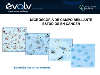 MICROSCOPÍA DE CAMPO BRILLANTE
                  ESTUDIOS EN CÁNCER




Evolución tras varias semanas
 