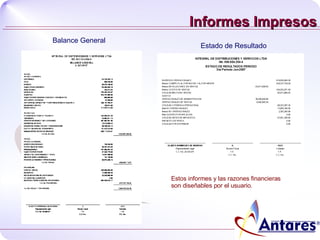 Informes Impresos Balance General  Estado de Resultado  Estos informes y las razones financieras son diseñables por el usuario. 