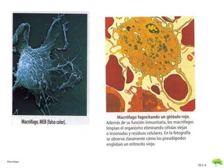 M.E.S 
Macrofagos 
 
