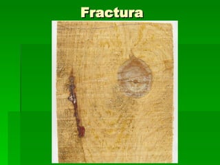 Fractura 
