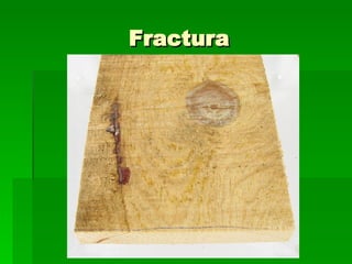 Fractura 