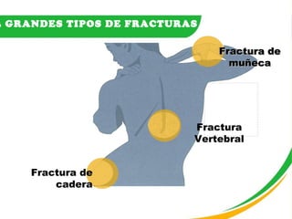 3 GRANDES TIPOS DE FRACTURAS Fractura de muñeca Fractura Vertebral Fractura de cadera 