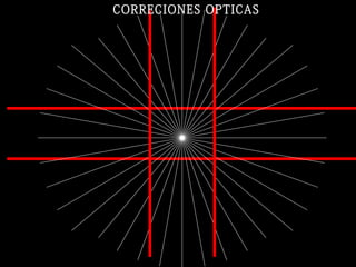 CORRECIONES OPTICAS
 