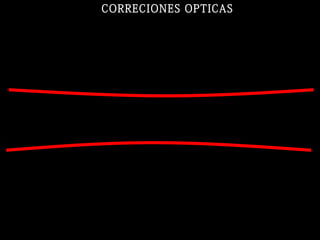 CORRECIONES OPTICAS
 