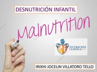 DESNUTRICIÓN INFANTIL
IRIXHI JOCELIN VILLATORO TELLO
 