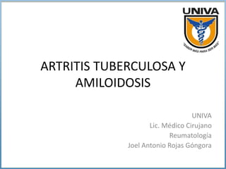 ARTRITIS TUBERCULOSA Y
AMILOIDOSIS
UNIVA
Lic. Médico Cirujano
Reumatología
Joel Antonio Rojas Góngora
 
