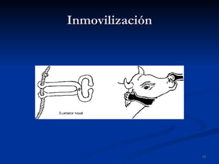 Inmovilización 