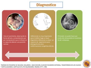 •tras el nacimiento, observando la 
forma del pie y comprobando que 
por manipulación que el niño(a) no 
es capaz de obtener una posición 
normal. 
•diferencial: es muy importante 
que el médico haga un buen 
diagnóstico diferencial, es decir se 
requiere de experiencia para 
distinguirlo de otras 
malformaciones congénitas del pie. 
•Prenatal: se puede hacer por 
medio del ultrasonido en la semana 
16 del embarazo. 
TRATADO DE PEDIATRIA DE NELSON; VOLUMEN I; 18VA EDICION; ELSEVIER FOUNDERS EDITORIAL; TRANSTORNOS DE LOS HUESOS 
Y ARTICULACIONES; CAPITULO 673; PIE EQUINOVARO; PAGINA 2777- 2780 
 