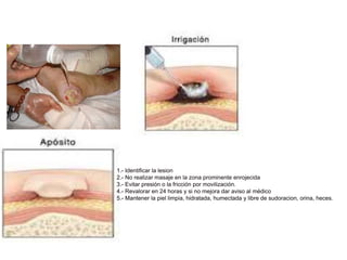 1.- Identificar la lesion
2.- No realizar masaje en la zona prominente enrojecida
3.- Evitar presión o la fricción por movilización.
4.- Revalorar en 24 horas y si no mejora dar aviso al médico
5.- Mantener la piel limpia, hidratada, humectada y libre de sudoracion, orina, heces.
 