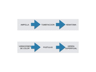 AMPOLLA TUMEFACCION HEMATOMA
VARIACIONES
DE COLOR
PUSTULAS
HERIDA
SUPERFICIAL
 
