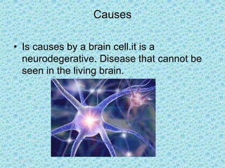 16/03/2017
Causes
• Is causes by a brain cell.it is a
neurodegerative. Disease that cannot be
seen in the living brain.
 