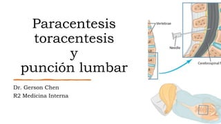 Paracentesis
toracentesis
y
punción lumbar
Dr. Gerson Chen
R2 Medicina Interna
 