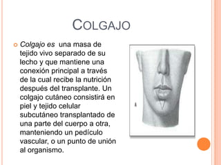 COLGAJO
 Colgajo es una masa de
tejido vivo separado de su
lecho y que mantiene una
conexión principal a través
de la cual recibe la nutrición
después del transplante. Un
colgajo cutáneo consistirá en
piel y tejido celular
subcutáneo transplantado de
una parte del cuerpo a otra,
manteniendo un pedículo
vascular, o un punto de unión
al organismo.
 