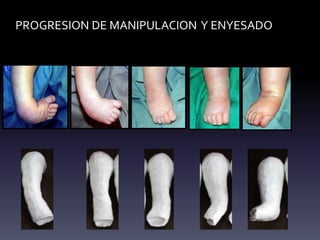 PROGRESION DE MANIPULACION Y ENYESADO
 