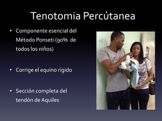 Tenotomia Percútanea
• Componente esencial del
Método Ponseti (90% de
todos los niños)
• Corrige el equino rígido
• Sección completa del
tendón de Aquiles
 