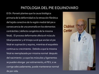 PATOLOGIA DEL PIE EQUINOVARO
El Dr. Ponseti planteo que la causa biológica
primaria de la deformidad es la retracción fibrótica
del tejido conectivo de la región medial del pie a
consecuencia de una anomalía en los elementos
contráctiles ( defecto congénito de la miosina
fetal). El proceso deformante afecta el músculo
tibial posterior y el tríceps sural que anclan el pie
fetal en supinación y equino, mientras el esqueleto
continua su crecimiento. Debido a que la miosina
fetal es reemplazada por miosina normal después
del nacimiento y a que los músculos y ligamentos
se pueden elongar por estiramiento, el PEV, si se
corrige adecuadamente, puede mantenerse normal
de por vida.
 