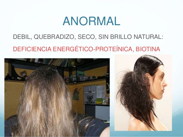 Signo De La Bandera En El Cabello es.slideshare.net