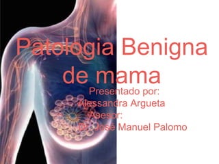 Patologia Benigna
de mamaPresentado por:
Alessandra Argueta
Asesor:
Dr. José Manuel Palomo
 